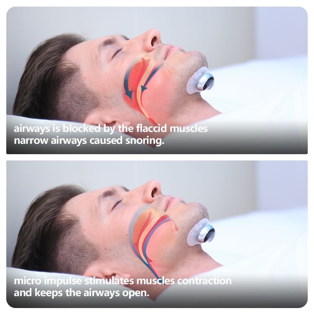 Smart Anti Snoring Device Electronic Muscle Stimulator - Image 10